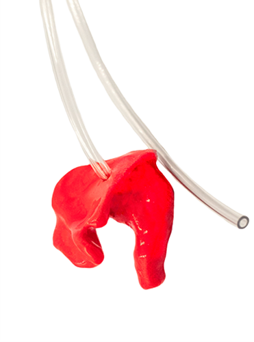 RedHalo earmold